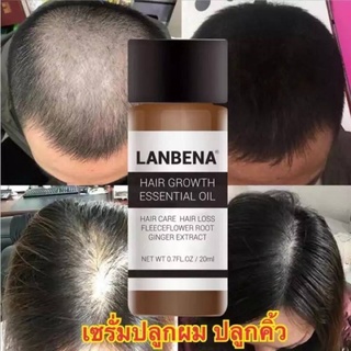 LANBENA Hair ผมดกขึ้นป้องกันศรีษะล้าน