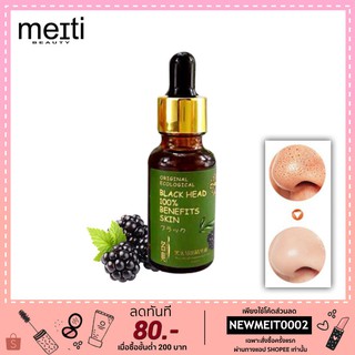 เซรั่มกำจัดสิวเสี้ยน ละลายสิวหัวดำ ฺBlackhead Exporting Essence Lotion 20ml