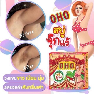 สบู่จุ๊กแร้ขาว OHO Underarm Whitening Soap