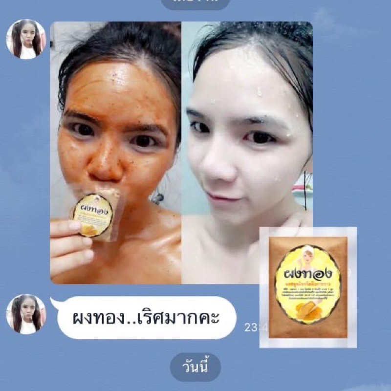 ผงทอง ขัดผิวขาวใส ของแท้จากบริษัท✨พร้อมส่ง ราคา ถูกที่สุด ดีลบีเคเค แกลเลอรีภาพที่ 7