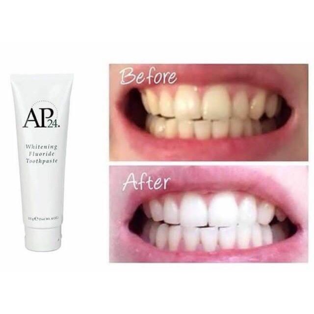 ‼️best seller‼️ยาสีฟัน ทรีทเม้น ฟันขาว AP24