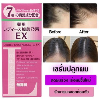 Kaminomoto Hair Ladies EX 150ml. เซรั่มปลูกผมสกัดจากสมุนไพรญี่ปุ่น KANPO รักษาโรคผมร่วง