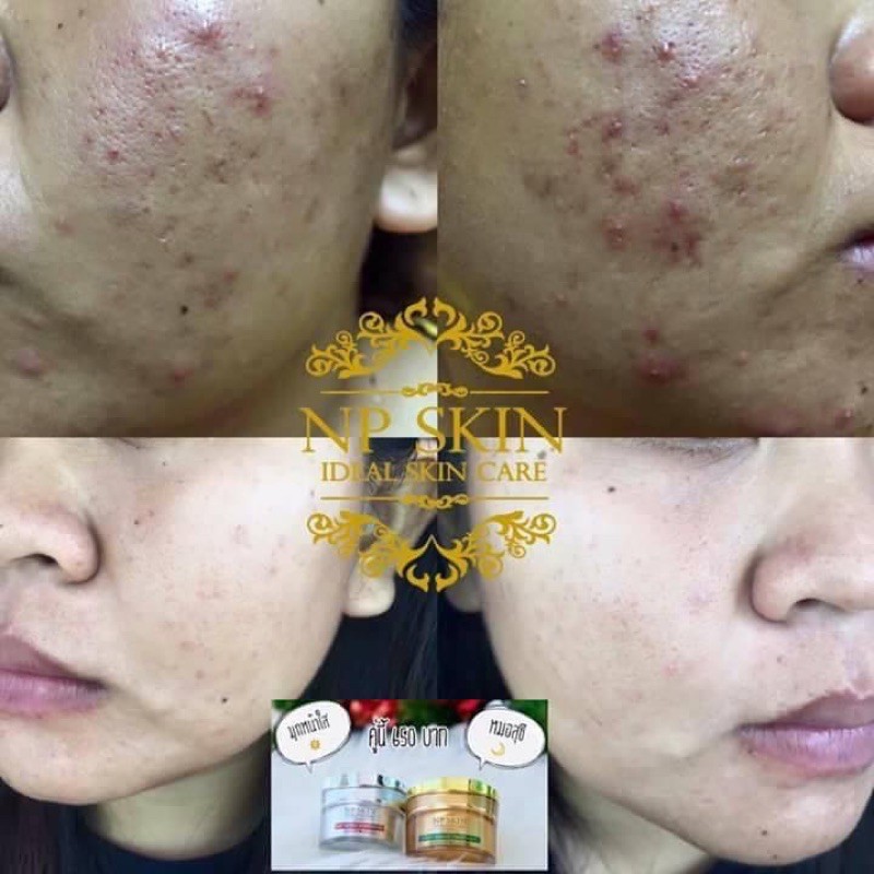 ในท์ครีม NP SKIN ❤️❤️❤️