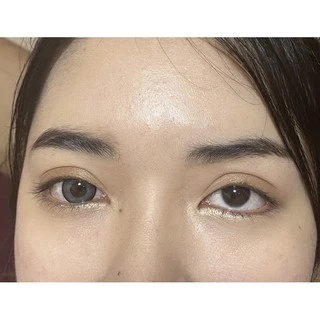 wink (Seeshall) ตาโต 14.5