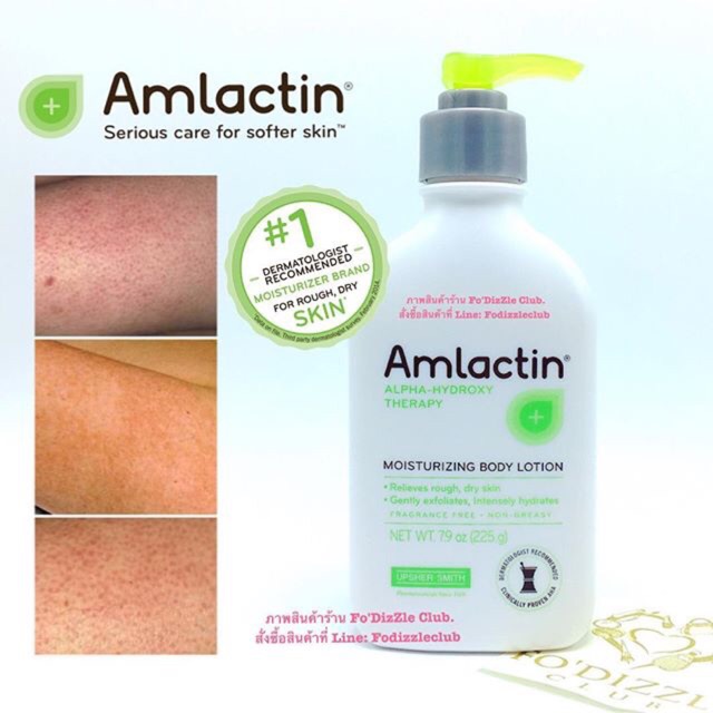 Amlactin Moisturizing Lotion 12 Lactin Acid ร กษาขนค ด Shopee Thailand