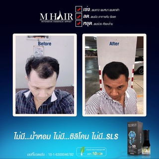 MHAIR เซรั่มปลุกผม หัวล้าน ผมบาง แก้ปัญหาผมหลุดล่วง บำรุงเส้นผมให้แข็งแรง ลดการเกิดผมงอก