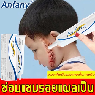 จัดส่งทุกวันAnfany ครีมลดรอยแผลเป็น ลดรอยแผลเป็น รอยสิว ลบรอยแผลเป็น สำหรับรอยสิว แผลเผาไหม้ แผลเป็นจากการผ่าตัด