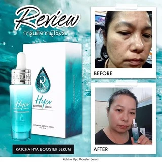 Ratcha Hya Booster Serum เซรั่มไฮยา บูสเตอร์ By น้องฉัตร (15 ml. x 1 กล่อง)