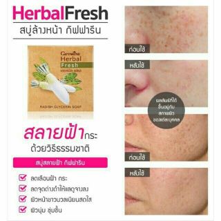 สบู่หัวไชเท้า Herbal Fresh สบู่ล้างหน้า ลดฝ้า ลดสิว 110฿