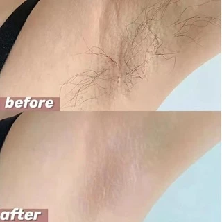 Hair Removal มูสกำจัดขน สเปรย์กำจัดขน ครีมกำจัดขนรักแร้ ขนขา มูสกำจัดขนถาวร ครีมขจัดขน ครีมกำจ