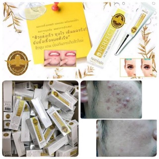 Arbutina PERFECT ACNE GEL