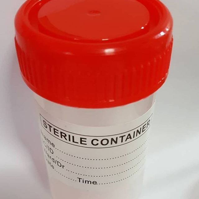 Sterile Specimen Cup 60ml with label (500pcs/box) Shopee Thailand