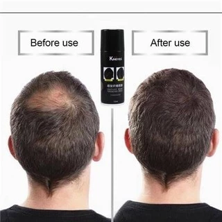 Kingyes Hair Spray สเปรย์ผม ไฟเบอร์ ปิดผมบาง ผมขาว แก้ปัญหาหัวล้าน 130 ml