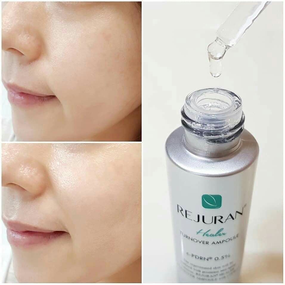 (แท้ พร้อมส่ง) Rejuran Healer Nutritive Cream 50mL Turnover Ampoule 30