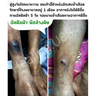 🌱อัลฟัลฟ่า​ Alflafa​🎖️ของแท้💯% มีรีวิว​จริง👍💥ล้างพิษ​ สร้างภูมิ ผิวใส​ ผิวขาว​ ดี​ท็อกซ์​ detox​ กรดไหลย้อน​ อัลฟาฟ่า