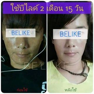 รับจากบริษัทโดยตรง 🌟 ครีม บีไล Belike บีไลค์ แก้ปัญหา สิว ฝ้า กระ หน้าหมองคล้ำ ขาว ไม่มีสารอันตราย