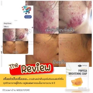 [ส่งไวมาก เปิดขนส่งเอง] สบู่พิมพ์เพกา ลดสิว หน้าสว่างใสอย่างเป็นธรรมชาติ