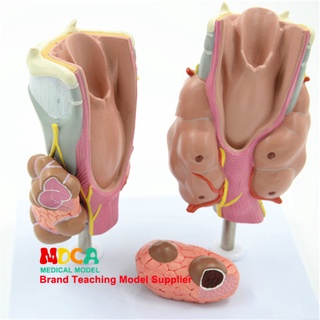 Human Anatomy Model Hyperthyroidism, hypothyroidism, ระบบต่อมไร้ท่อของมนุษย์, กายวิภาคทางการแพทย์, แบบจำลองทางพยาธิวิทยา