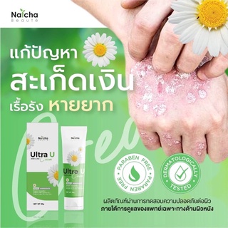 ของแท้ 100% *** นัชชา ณัชชา โบเต้ อัลตร้ายู Natcha Beaute Ultra U ปัญหาผิวลอก ภูมิแพ้ผิวหนัง ผดผื่นคัน ส้นเท้าแตก สะเก็ด