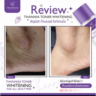 (1 ขวด)ธัญนิสาโทนเนอร์ THANNISA TONER ของแท้