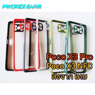 เคส Poco X3 NFC / Poco X3 Pro หลังใสอะคริลิค กันกล้อง ขอบกันลื่น กันกระแทก