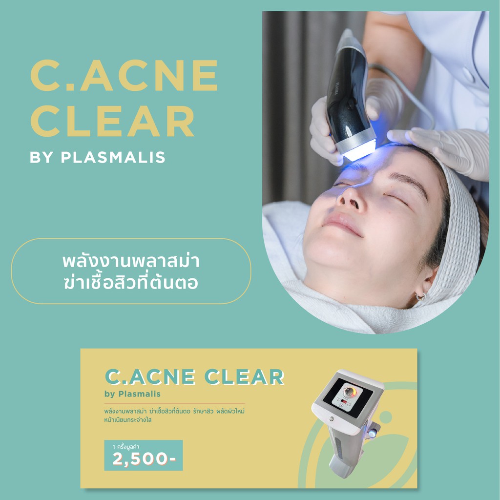 [Gift Voucher] บัตรของขวัญ พลังงานพลาสม่าฆ่าเชื้อสิว 1 ครั้ง C.Acne Clear by Plasmalis