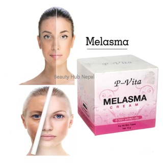 ⚡FLASH SALE⚡♡พร้อมส่งP-VITA Melasma Creamของแท้100%