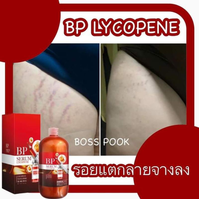 BP Serum Lycopene‼️💓💞