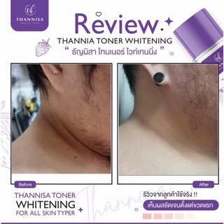 (1 ขวด)ธัญนิสาโทนเนอร์ THANNISA TONER ของแท้