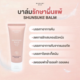 CLOUD BABY BALM บาล์มรักษาผื่นภูมิแพ้ผิวหนังทุกชนิด🍃🍃