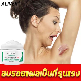 【มีสินค้าพร้อมจัดส่ง】Aliver 50ml ครีมลดรอยแผลเป็น  ลบรอยครีมแผลเป็น ครีมรักษาแผลเป็น ยาทาแผลเป็น ลดรอยแผลเป็น