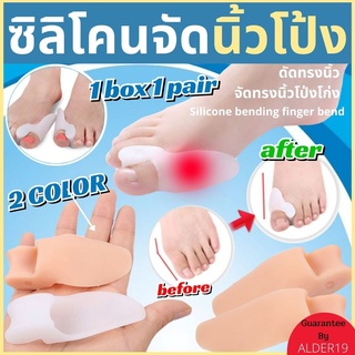 ป้องกัน ตาปลา ซิลิโคนรองเท้า 1 คู่ สุ่มสี Silicone bending finger bend ซิลิโคนดัดนิ้วโก่ง ซฺลิโคนเท้า จัดระเบียบทรงนิ้ว