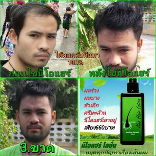นีโอแฮร์โลชั่น 💪 📦✔ Neo Hair Lotion ของแท้