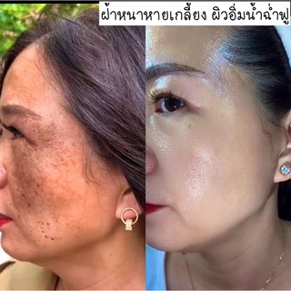 เซรั่ม WinkWhite เซรั่มหมอณัฐ