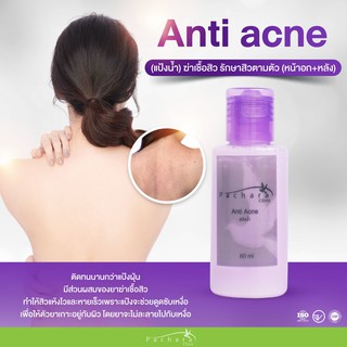 Anti acne รักษาสิวตามตัว เป็นยารักษาสิวตามตัว (หน้าอก+หลัง)  แป้งน้ำ