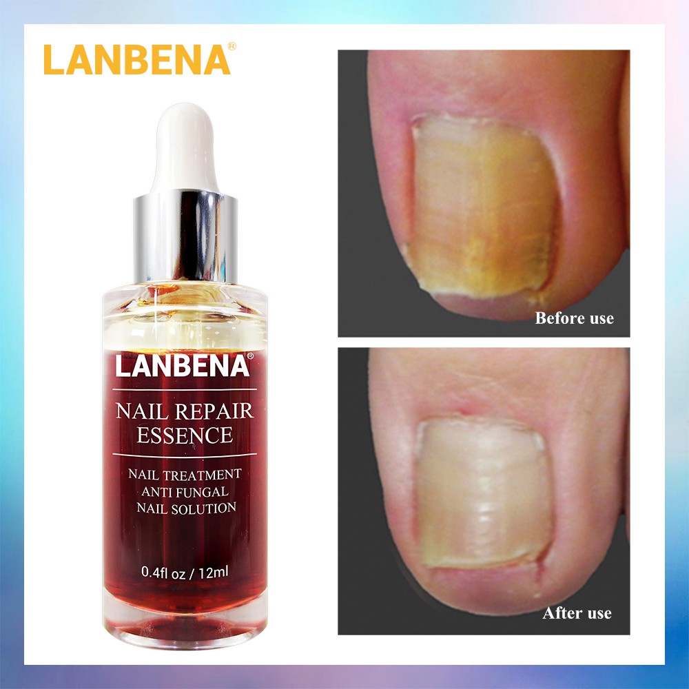 LANBENA Nail Repair Essence แก่นซ่อมเล็บ | Shopee Thailand