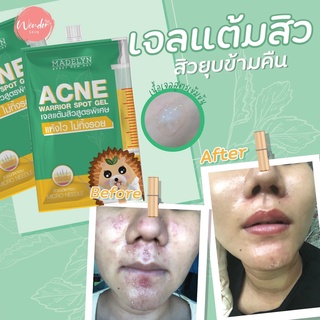 Madelyn Ance Spot เจลแต้มสิวตัวดัง นวัตกรรมจากเกาหลี (แบบกล่อง)