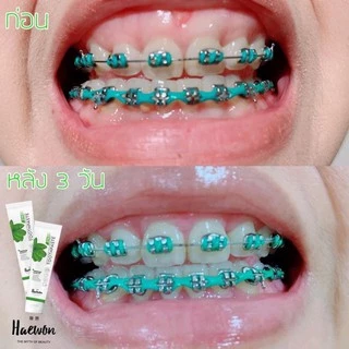 [หลอดใหญ่ สีฟ้าแถมแผ่นเฉด] Haewon Fresh Whitening แฮวอน เฟรช ไวท์เทนนิ่ง ยาสีฟัน ฟันขาว ปากหอม