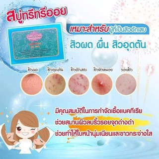 สบู่รักษาสิว✨ทรีทรีออย #สำหรับผิวมัน เป็นสิว ผิวแพ้ง่าย ใช้กับผิวหน้าโดยเฉพาะ