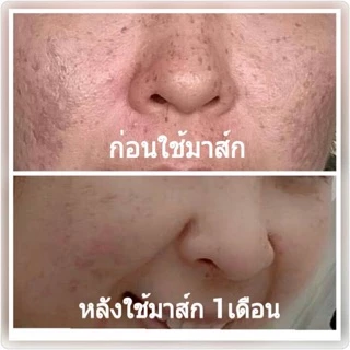 Fall in love Hensica White Mask ฟอลอินเลิฟ เฮนซิก้า 30g ครีมมาส์กหน้าขาว ลดฝ้าหนา กระลึก จุดด่างดำ รอยสิว ผิวโทรม 30g