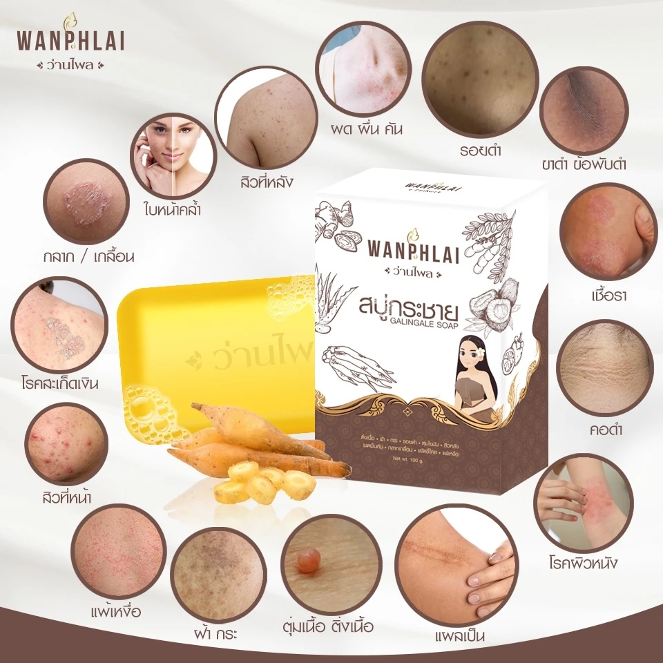 สบู่กระชายว่านไพล กำจัดติ่งเนื้อ ฝ้ากระ คอดำ ใบหน้าคล้ำ แก้ปัญหา กลาก เกลื้อน เชื้อรา สะเก็ดเงิน สิวที่หน้า สิวที่หลัง