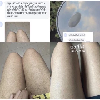 พร้อมส่ง ✨PWB ของแท้ 100%💕new packe💕ครีมบำรุงผิว ลดรอยแตกลาย รอยดำ รอยสิว รอยแผล มีบัตรตัวแทน