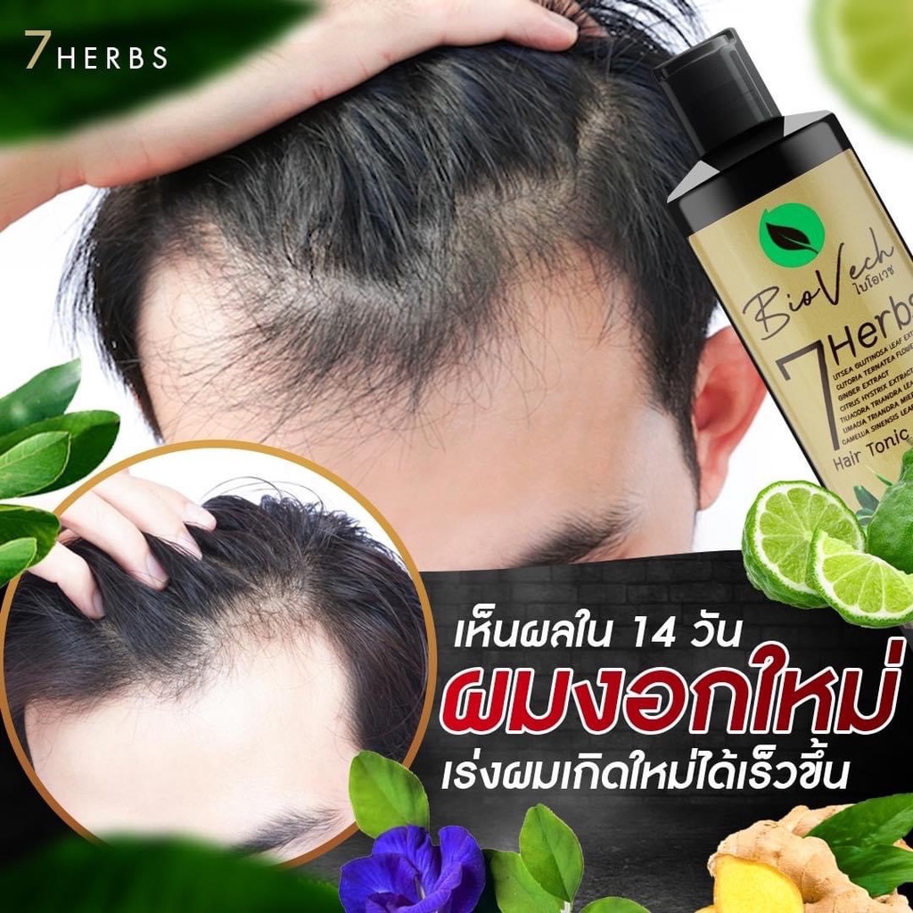 ชุดแชมพู 3 ขวด แชมพูไบโอเวช สุดคุ้ม เร่งผมยาว รูปที่ 4