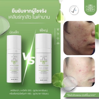 ส่งฟรี มีปลายทาง✅Acno Clear Cleanser เจลล้างหน้าลดสิว ใช้ได้กับทุกสภาพผิว 100ml 60ml✨ลดการเกิดสิวแมส✨Snow Princess