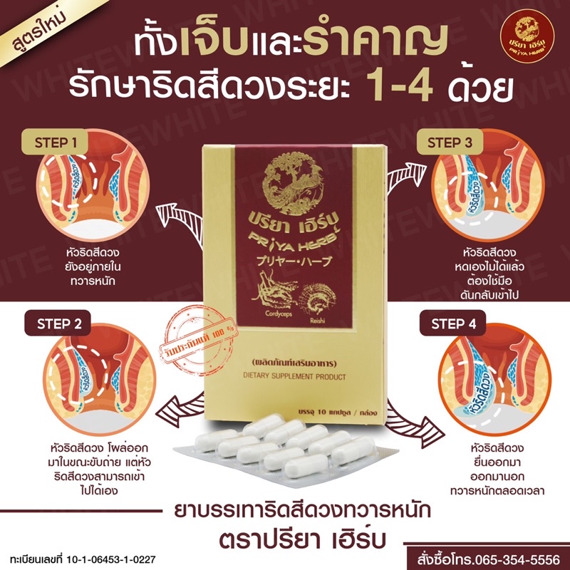 ยาริดสีดวง สมุนไพรปรียาเฮิร์บ (กล่องสีทอง) บรรเทาอาการริดสีดวงทุกระยะ แค่กินก็หายไม่ต้องผ่า