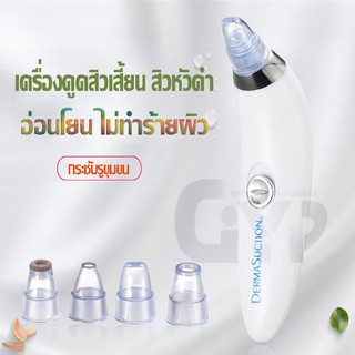 DERMASUCTION เครื่องดูดสิว สูญญากาศ ที่ดูดสิวเสี้ยน สิวข้างจมูก ดูดสิวเสี้ยนอุดตัน ลบรอยจุดดำจากสิวเสี้ยนที่จมูก สิวหัวด