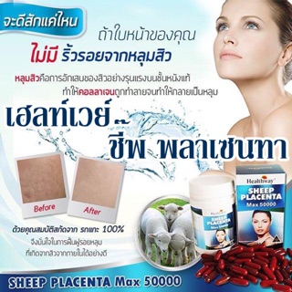 Healthway Sheep Placenta MAX 50000mg 100 เม็ด