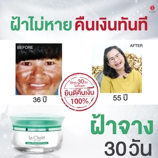 [ไม่เห็นผลยินดีคืนเงิน💯] ครีมรักษาฝ้า สารสกัดจากธรรมชาติ ครีมทาฝ้า ครีมลาชูเล่ lachule