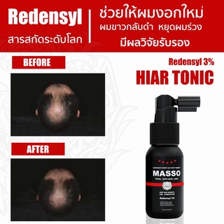 มัสโซ่ แฮร์โทนิค Masso Hair Tonic ผลิตภัณฑ์ ปลูกผม ป้องกันผมร่วง เพื่อผมหนา บำรุงรากผม