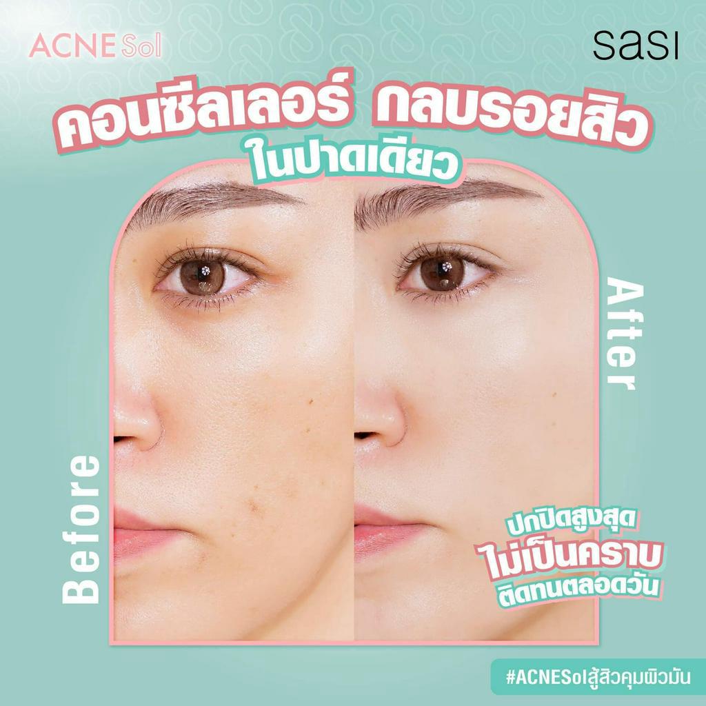 เพียวคอสSASI ACNE Sol Comfort Matteศศิ แอคเน่ โซล รูปที่ 5